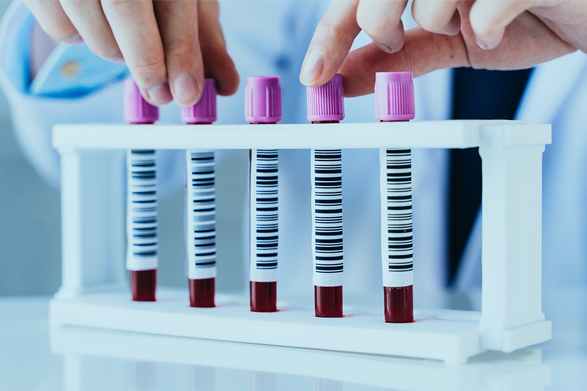 3partDifAnalyzers_LavenderTopBloodSamples_587x391_V1 Muestras de sangre en tubos con tapa color lavanda